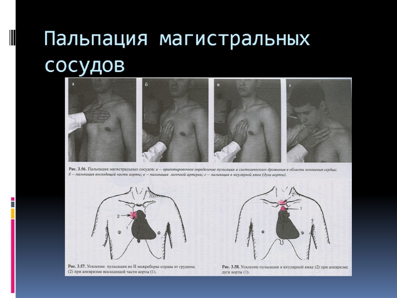 Пальпация магистральных сосудов